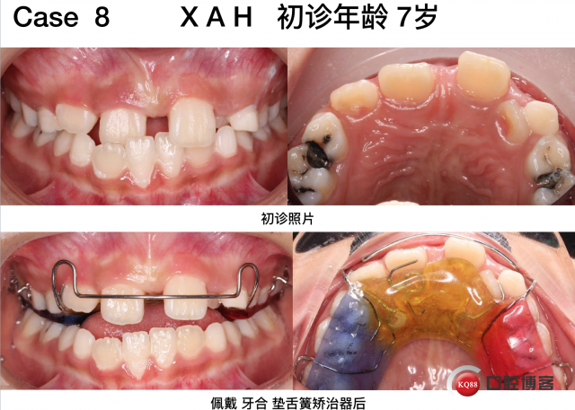 曾杰偉 第7頁