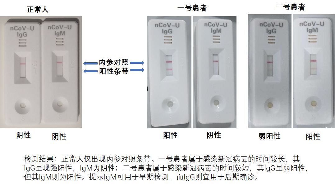 革新性檢測(cè)技術(shù)引領(lǐng)時(shí)代潮流，最新試紙問世！